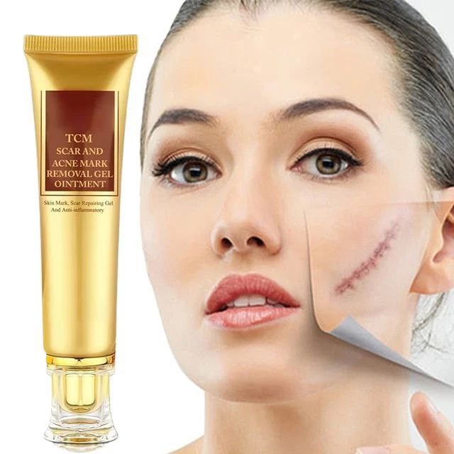 Aichun-Crème pour l'élimination des cicatrices d'acné, gel pour le visage, élimination des marques de boutons commandées, lissage de l'acné, blanchissant, hydratant, soins pour la peau du corps, 30g